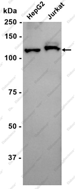Recombinant Eph receptor B3 Monoclonal Antibody - 1