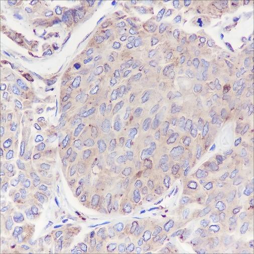 Recombinant GRP94 Monoclonal Antibody - small - 4