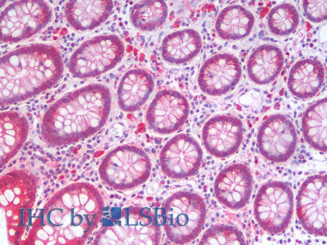 Immunohistochemistry analysis of paraffin-embedded Human Colon using Catenin beta Polyclonal Antibody(Elabscience Product Detected by Lifespan).