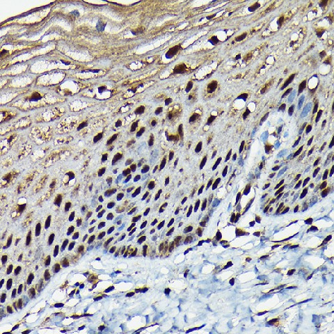 Immunohistochemistry of paraffin-embedded human normal cervix using BRCA1 Polyclonal Antibody at dilution of 1:100 (40x lens).Perform high pressure antigen retrieval with 10 mM citrate buffer pH 6.0 before commencing with IHC staining protocol.