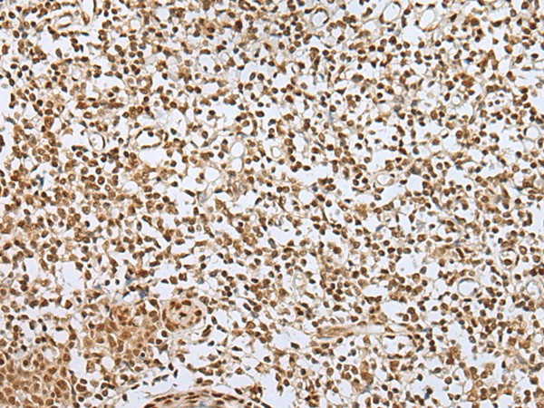 Immunohistochemistry of paraffin-embedded Human tonsil tissue  using ZNF354A Polyclonal Antibody at dilution of 1:40(?200)