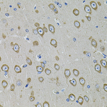 Immunohistochemistry of paraffin-embedded rat brain using PDE1B Polyclonal Antibody at dilution of 1:100 (40x lens).Perform microwave antigen retrieval with 10 mM PBS buffer pH 7.2 before commencing with IHC staining protocol.