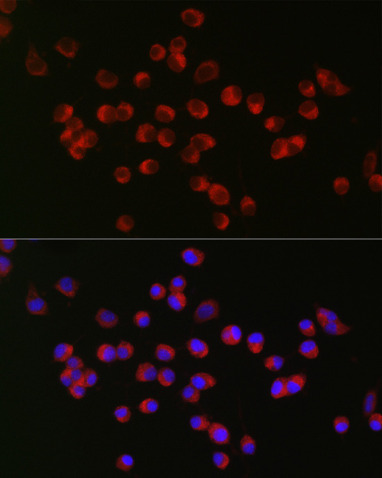 Immunofluorescence analysis of Neuro-2a cells using ANK3 Polyclonal Antibody at dilution of 1:200 (40x lens). Blue: DAPI for nuclear staining.