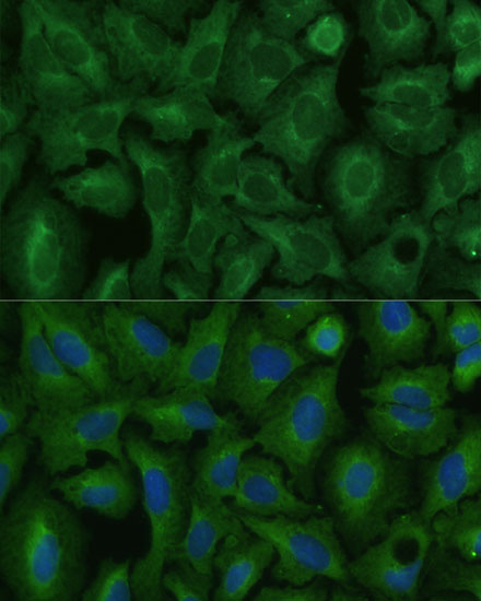 Immunofluorescence analysis of U-2 OS cells using TIMM8B Polyclonal Antibody at dilution of  1:100 (40x lens). Blue: DAPI for nuclear staining.