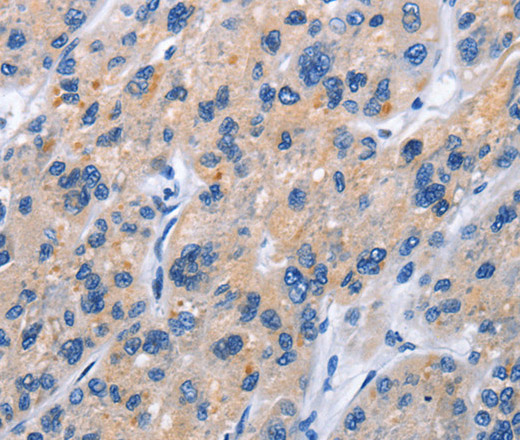 Immunohistochemistry of paraffin-embedded Human brain tissue using CD137 Polyclonal Antibody at dilution 1:50