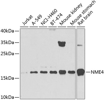 Western blot analysis of extracts of various cell lines using NME4 Polyclonal Antibody at 1:1000 dilution.