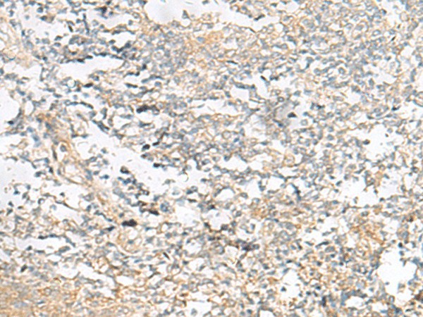 Immunohistochemistry of paraffin-embedded Human tonsil tissue  using HELT Polyclonal Antibody at dilution of 1:40(?200)