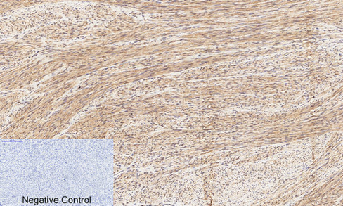 Immunohistochemistry of paraffin-embedded Human uterus tissue  using Phospho-CREB1 (Ser133) Polyclonal Antibody at dilution of 1:200