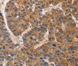 BABAM2 Polyclonal Antibody - 2