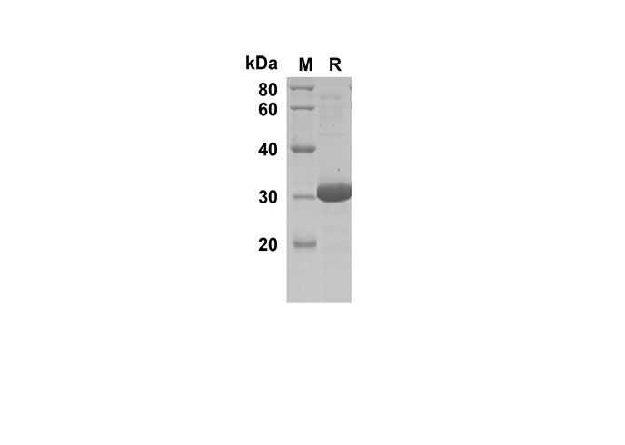 Recombinant Rat IL-6 Protein(Sumo Tag)-产品推荐-1