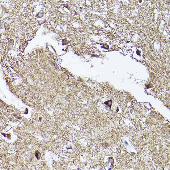 Immunohistochemistry of paraffin-embedded human brain using VDAC2 Polyclonal Antibody at dilution of 1:100 (40x lens).Perform high pressure antigen retrieval with 10 mM citrate buffer pH 6.0 before commencing with IHC staining protocol.