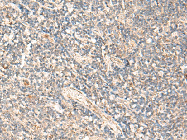 Immunohistochemistry of paraffin-embedded Human tonsil tissue  using MOB1A Polyclonal Antibody at dilution of 1:50(?200)