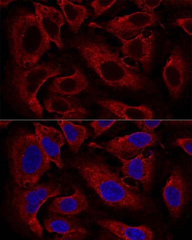 Confocal immunofluorescence analysis of U2OS cells using ARL8B Polyclonal Antibody at dilution of  1:100. Blue: DAPI for nuclear staining.