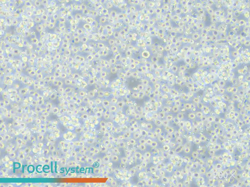 Jurkat clone A3[A3] Cell Complete Medium - small - 5