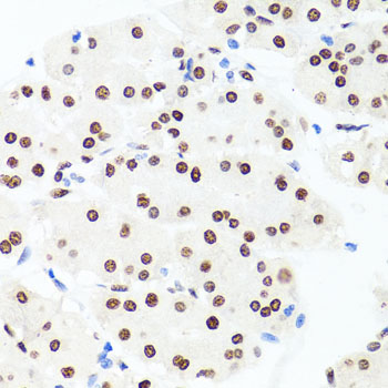Immunohistochemistry of paraffin-embedded Human stomach using Histone H1.0 Polyclonal Antibody at dilution of 1:100 (40x lens).