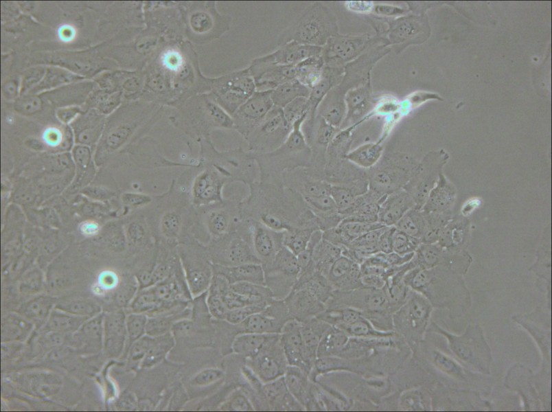 SCC-9 [SCC 9; SCC9] Cell Complete Medium - small - 6