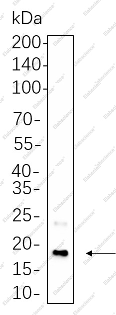Recombinant CENP-A Monoclonal Antibody - 1