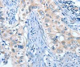 ANGPT2 Polyclonal Antibody - 2