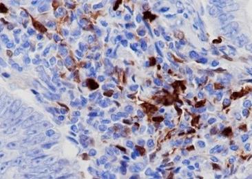 Recombinant IDO1 Monoclonal Antibody-searchlist-1