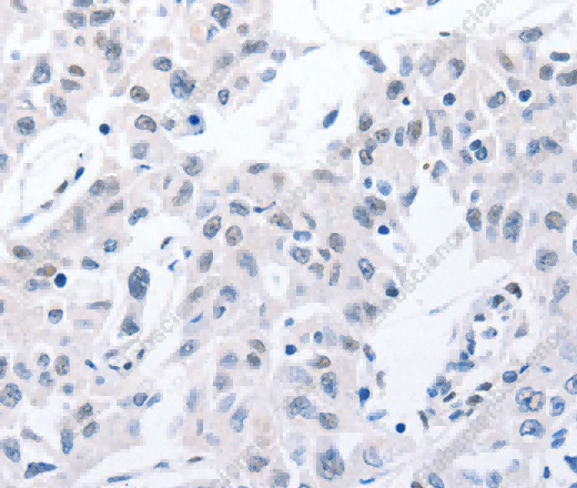 POMC Polyclonal Antibody - 3