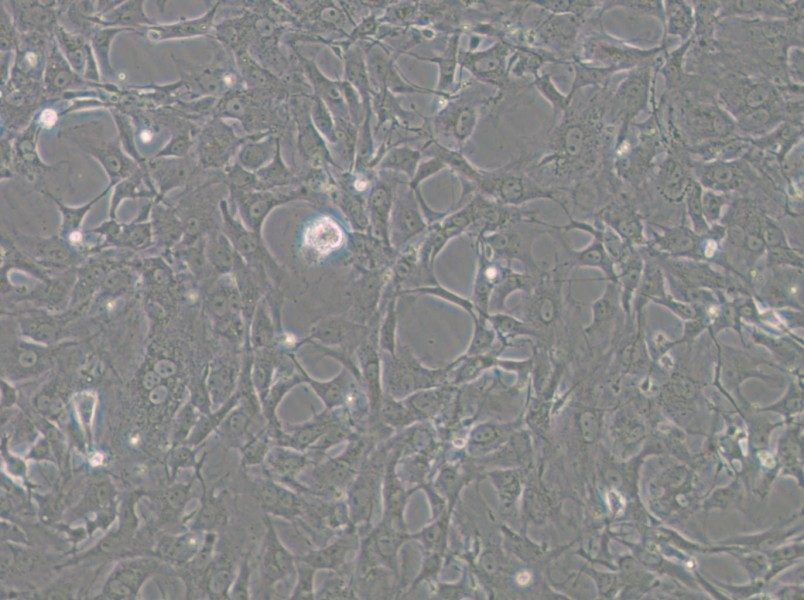 Tb 1 Lu Cell Complete Medium - small - 5