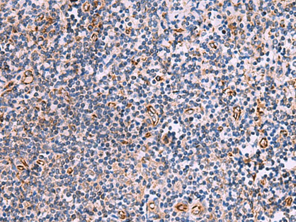 Immunohistochemistry of paraffin-embedded Human tonsil tissue  using ITGA11 Polyclonal Antibody at dilution of 1:75(?200)