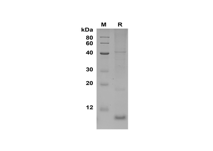 Recombinant Human CCL22 Protein-1