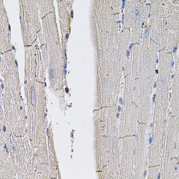 Immunohistochemistry of paraffin-embedded Mouse heart using GLUT3 Polyclonal Antibody