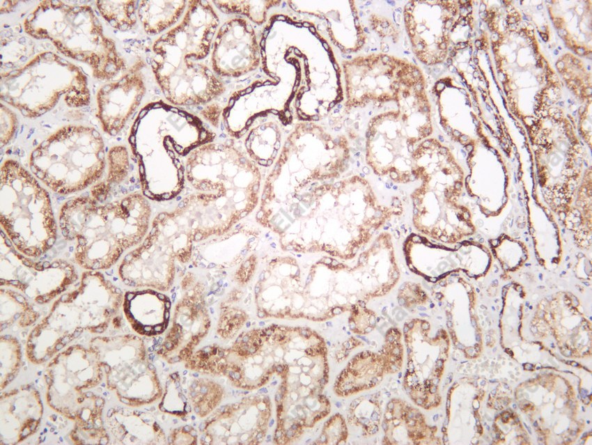 Recombinant SOD2 Monoclonal Antibody - 4