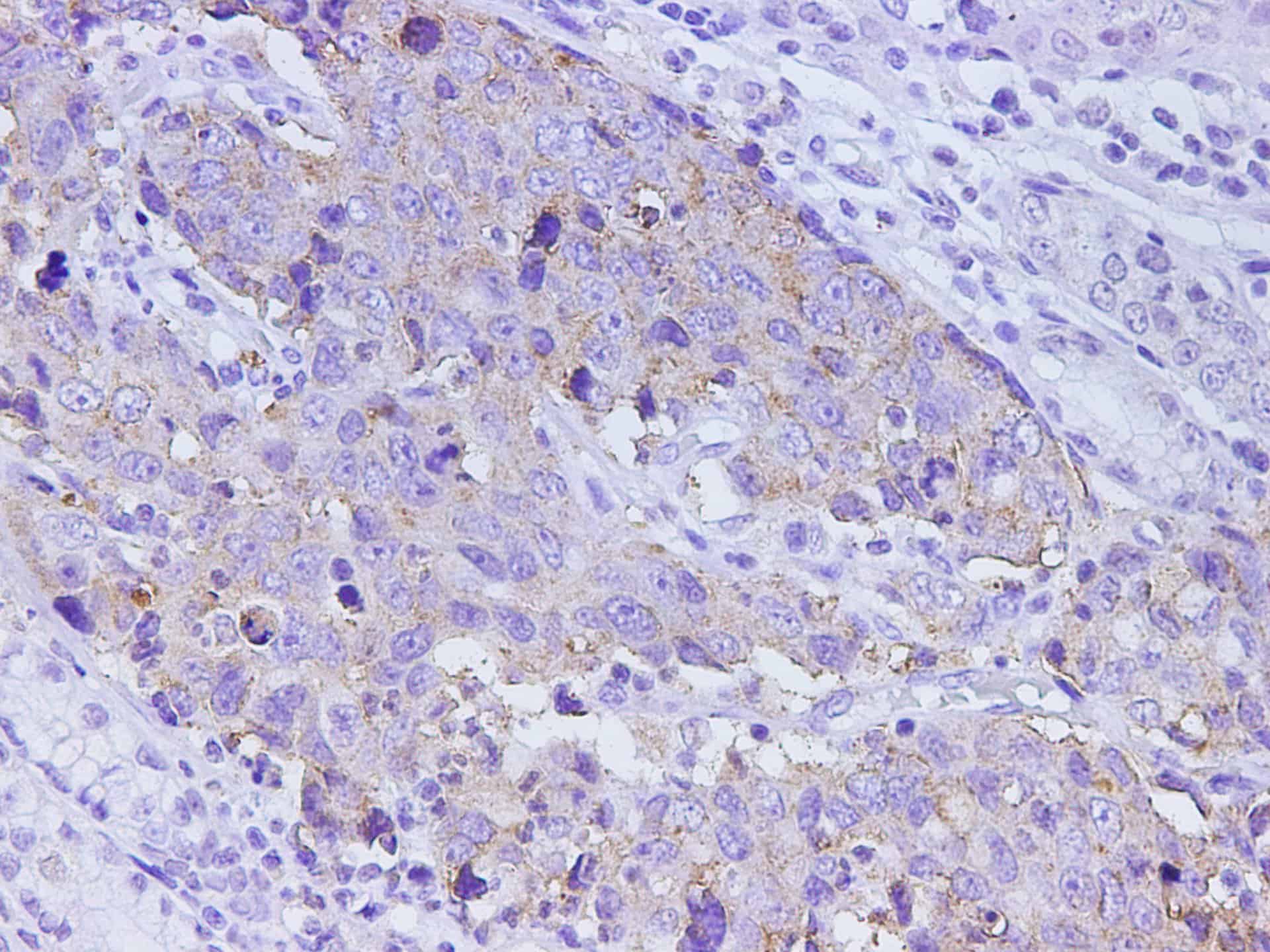 Purified Mouse IgG1, κ Isotype Control[MOPC-21]-产品推荐-4