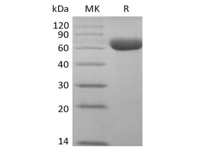 Immobilized Cynomolgus Siglec-15-Fc(Cat#PKSQ050112) at 2ug/ml (100 ul/well) can bind Anti-Human Siglec15 mAb. The ED50 of Anti-Human Siglec15 mAb is 20.9 ng/ml.