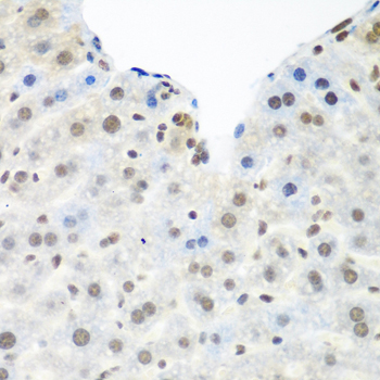TARDBP Polyclonal Antibody - small - 2