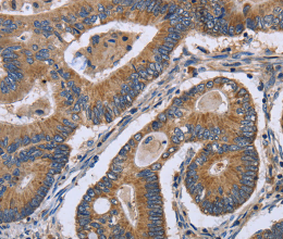 GABPB2 Polyclonal Antibody - 2
