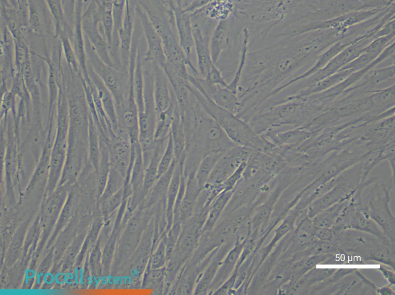Human Chondrocyte Complete Medium - 5