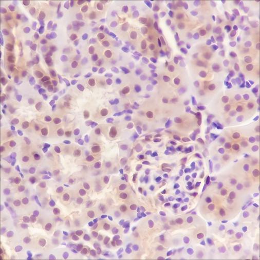 Recombinant SBDS Monoclonal Antibody - small - 5