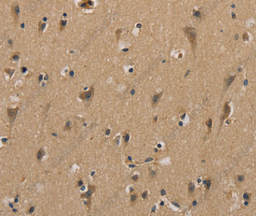 MYL3 Polyclonal Antibody - 3