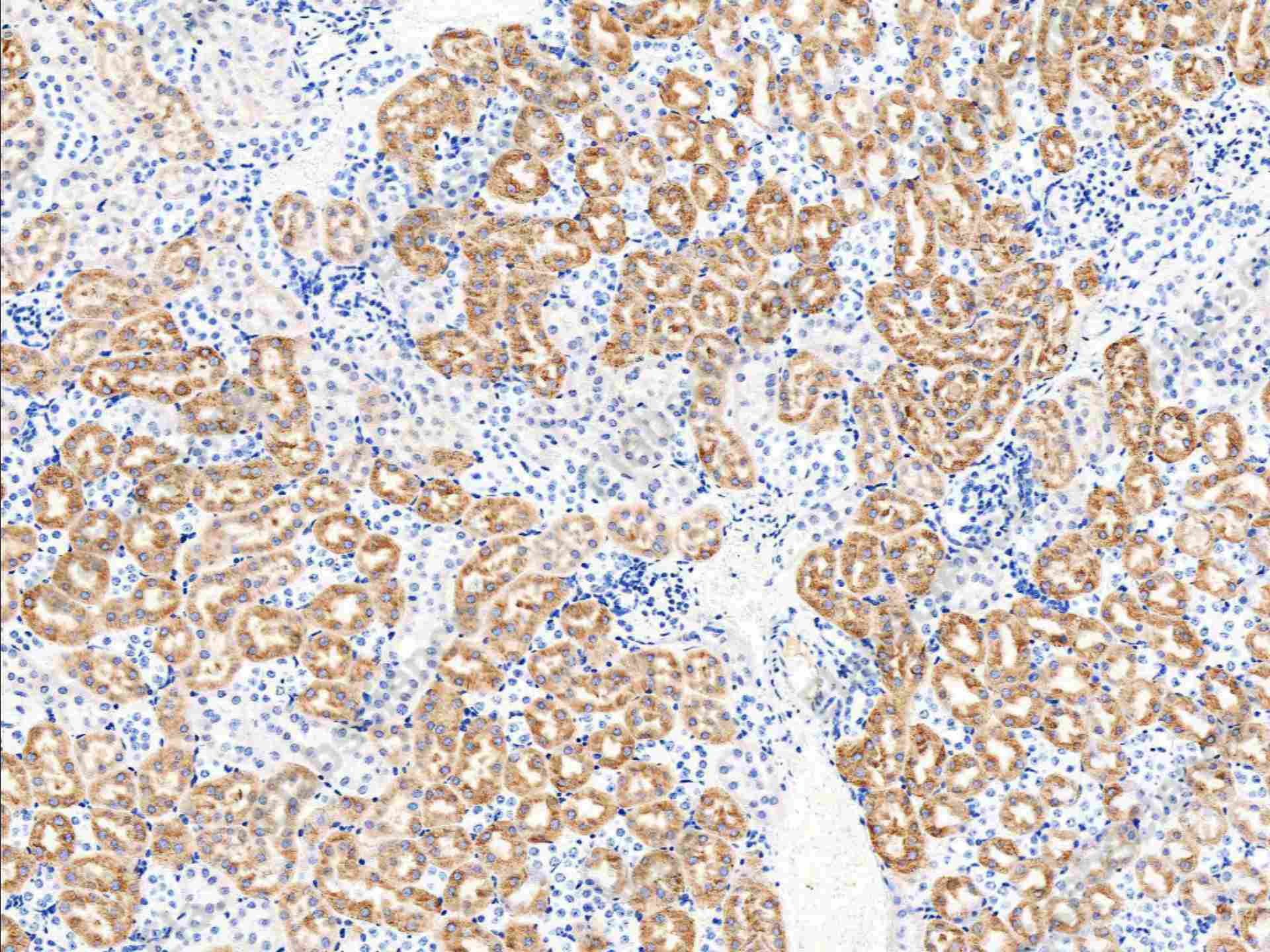 Recombinant EGFR/HER1/ErbB1 Monoclonal Antibody - 2