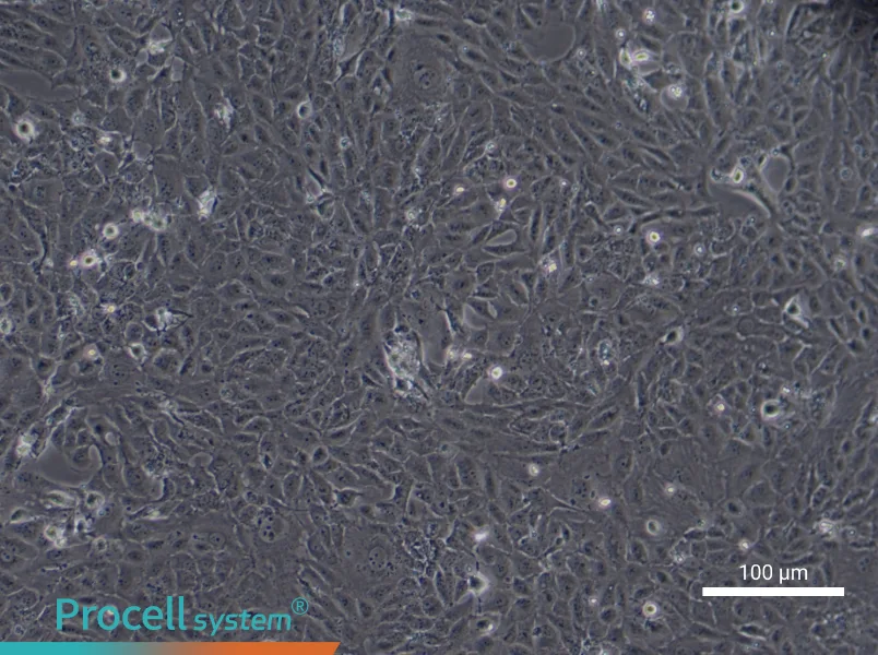 Human Type II Alveolar Epithelial (Primary cell immortalization) Cell Complete Medium - 7