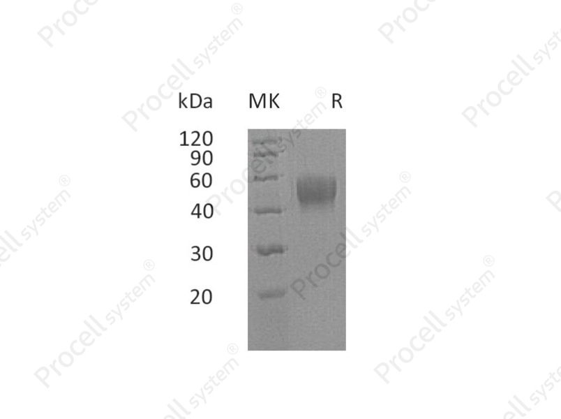 IL-10RB/IL-10R2, Human, Recombinant