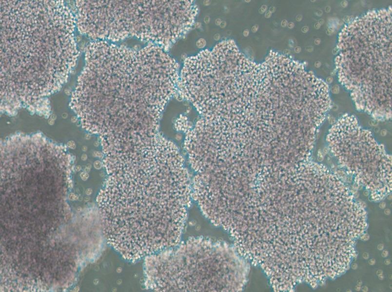 NCI-H1417 Cell Complete Medium - 2