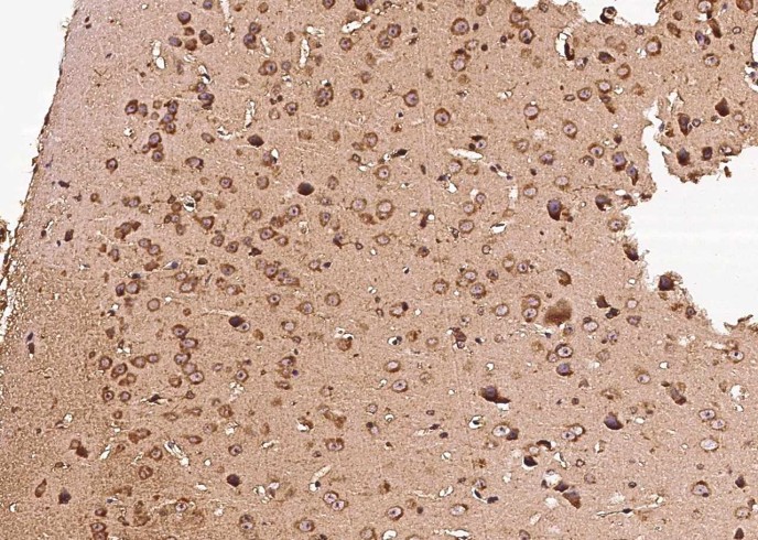 Recombinant GFRA1 Monoclonal Antibody - small - 2