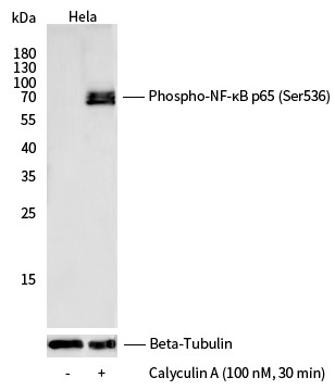 Recombinant Phospho-NF-κB p65 (Ser536) Monoclonal Antibody - small - 2