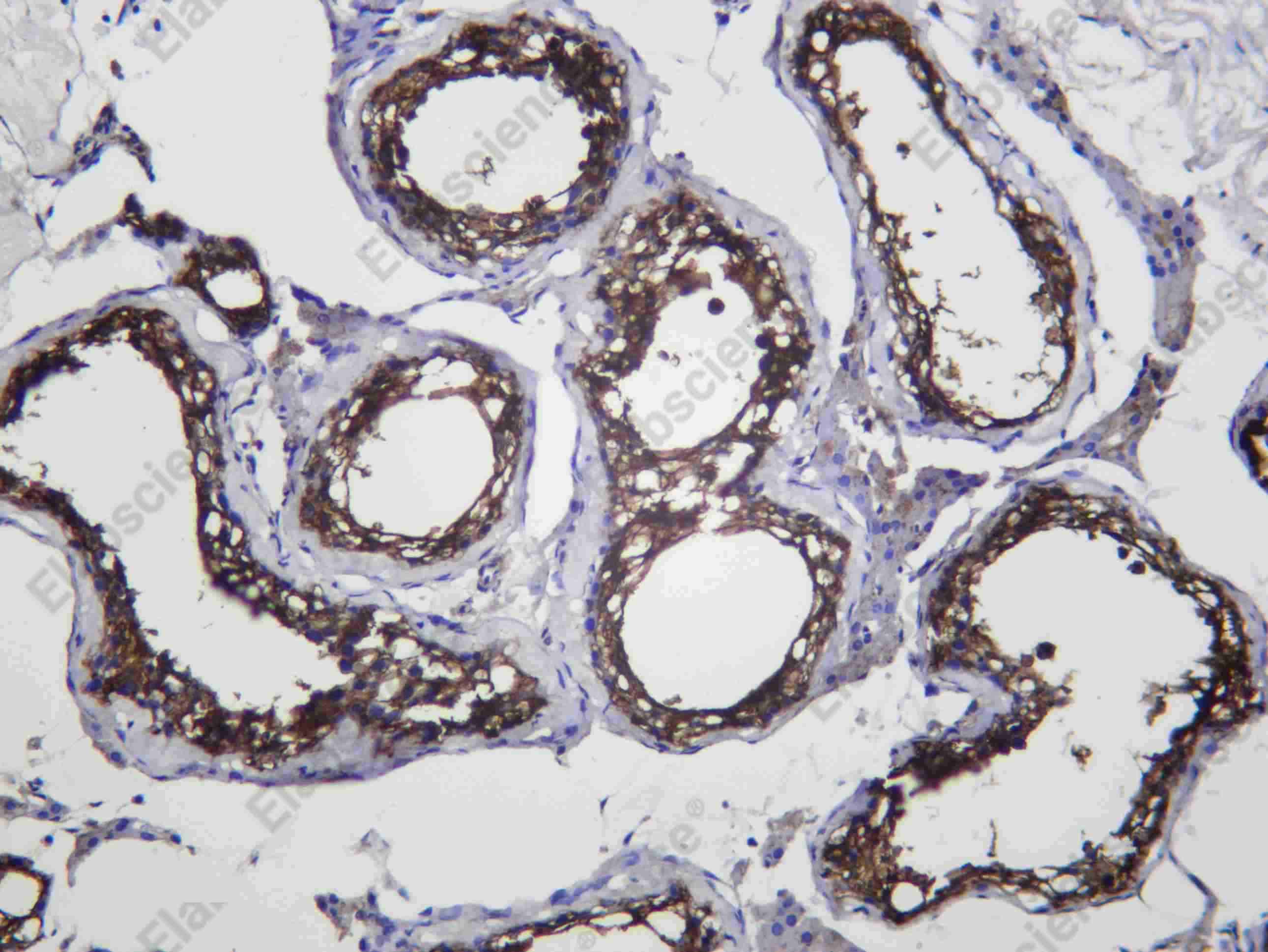 Recombinant TBB4A Monoclonal Antibody - 2