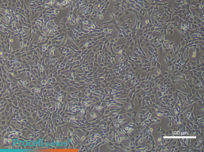 Mouse Pulmonary Artery Endothelial Cells (Primary cell immortalization)Mouse Pulmonary Artery Endothelial Cells (Primary cell immortalization) - 2