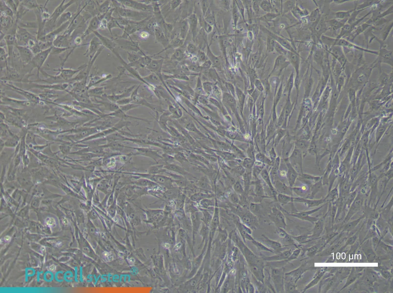 Human Umbilical Cord Mesenchymal Stem Cell Complete Medium - 3