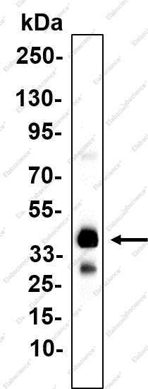 Recombinant CD79b Monoclonal Antibody - 1