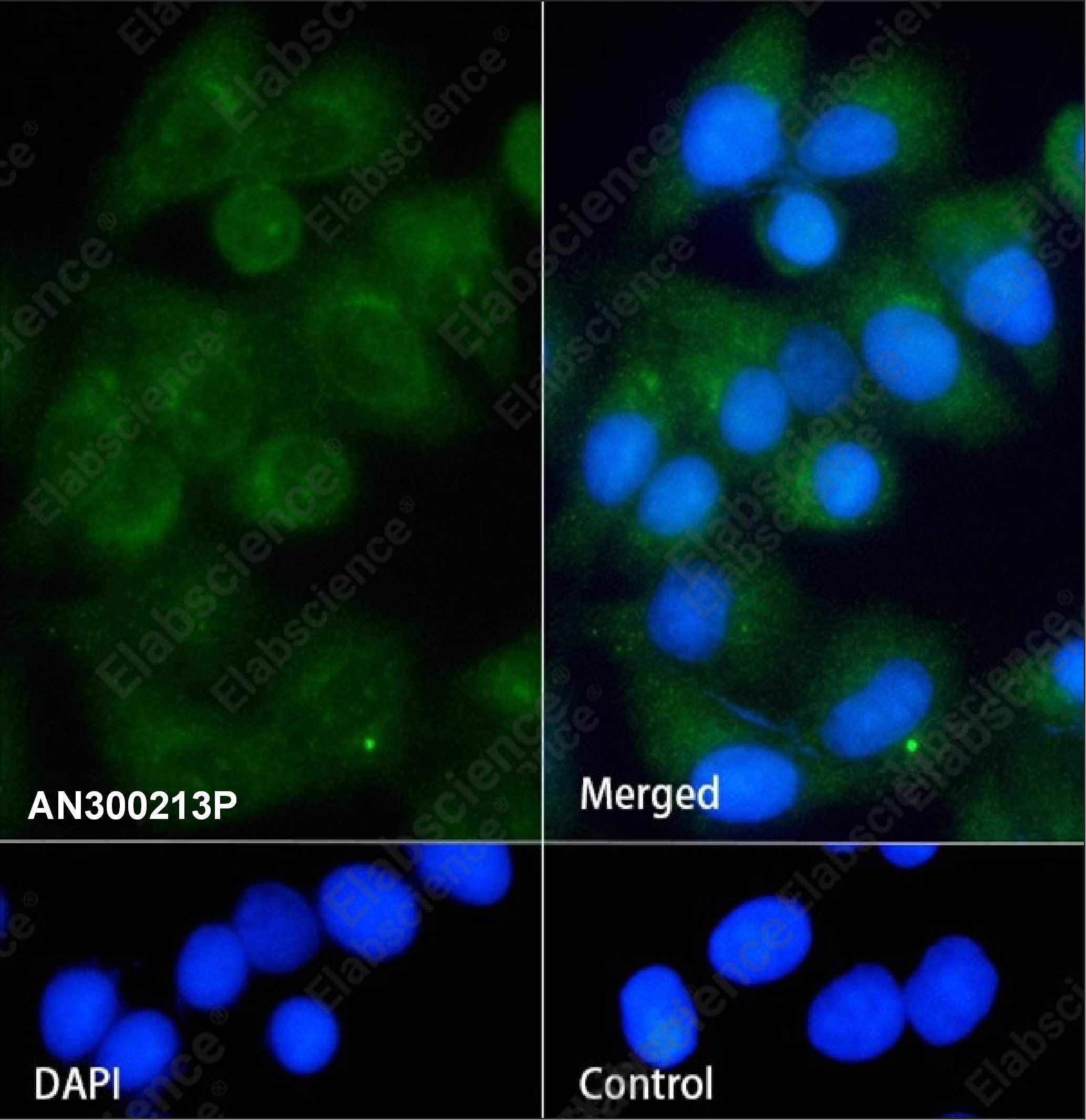 Recombinant SerpinA8/Angiotensinogen/AGT Monoclonal Antibody - 2