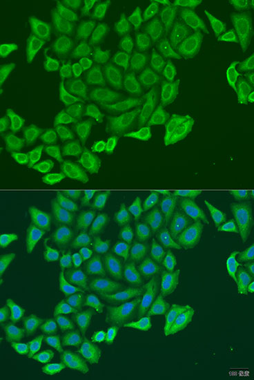 Immunofluorescence analysis of U2OS cells using EXOC2 Polyclonal Antibody at dilution of 1:100. Blue: DAPI for nuclear staining.