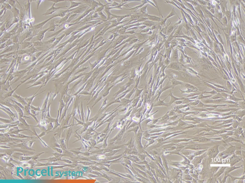 Human Uterine Fibroblast Complete Medium - 2