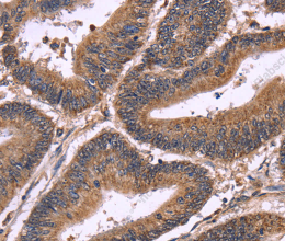 SEPT7 Polyclonal Antibody - 2